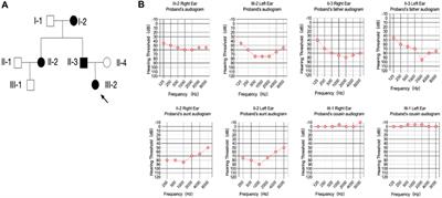 Novel cis compound heterozygous variants in MYO6 causes early onset of non-syndromic hearing loss in a Chinese family